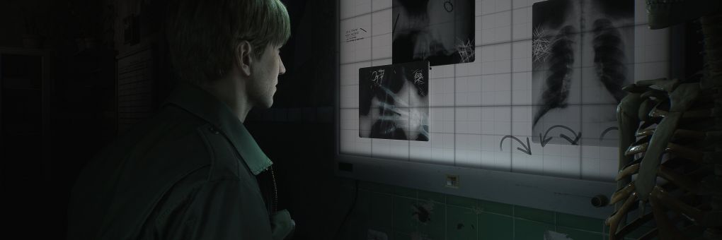 Silent Hill 2 sztori trailer, Nintendo Museum leleplezés – ez történt hétfőn